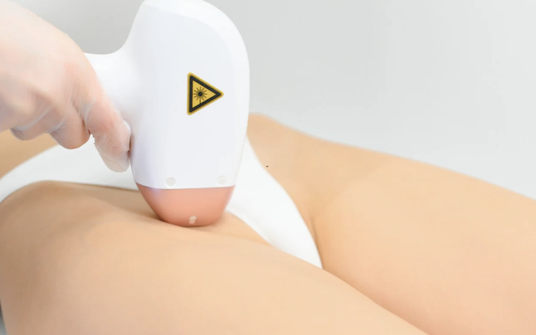 Laser Hair Removal Treatments Near Bethesda, Maryland
